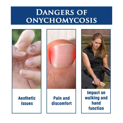 Nail Repair Pencil: Enhance & Strengthen Nails Today!