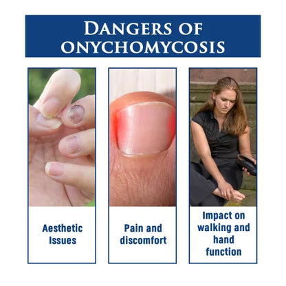 Nail Repair Pencil: Enhance & Strengthen Nails Today!